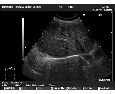 超音波画像例3